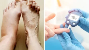 ডায়াবেটিসের বিপজ্জনক লক্ষণগুলো