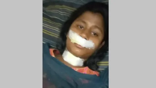নেত্রকোণায় স্কুলছাত্রীকে ধর্ষণ চেষ্টা, বাধা দেওয়ায় গলা ও ঠোটে ছুরিকাঘাত